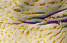 Crow's feet, 3D skin analysis before use