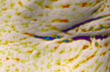 Crow's feet, 3D skin analysis after one use