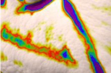 Nasolabial fold, 3D skin analysis before use