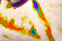 Nasolabial fold, 3D skin analysis after one use