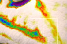 Nasolabial fold, 3D skin analysis after two weeks